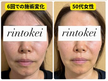 凛と慶/長居-美容鍼・ダイエット