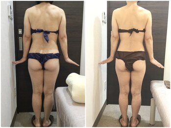 ウェリナ 一宮院/小顔矯正/骨盤矯正/痩身整体