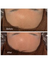 ビビ(VIVI)/ララピールで艶肌に