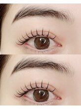 アンドユー(&you)/LEDエクパーマ