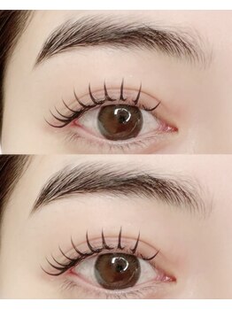 アンドユー(&you)/LEDエクパーマ