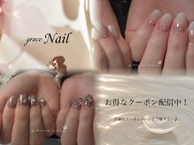 アクイール グラッセ(Accueillir grace)