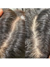 シュール センター南(SURREAL)/ヘッドスパ後のビフォーアフター