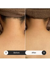 チャンティック(Cantik)/ブライダルケアのお客様♪