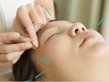 梅沢鍼灸院の写真/二重あごやエラのハリが気になる方に！美容鍼で内側から理想の小顔へ♪速攻性のある施術で効果満足度◎
