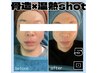 お顔人気NO１★温熱4000ショット×コルゾウ90分14,000円