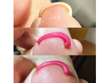 ラララン(Lalalan)の雰囲気（巻き爪補正は即効果を実感！しっかり角質ケアで元に戻りづらく）
