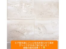 カワル(kawaru)/脱毛後こんなに抜けました！