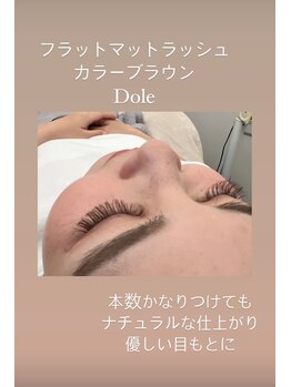 アミークス(Amicus)/