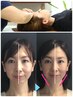 【小顔ケア＆歪み改善】小顔調整＋全身調整カイロ　100分 ￥15,000→￥10,000