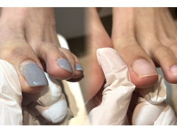 リリー 銀座(Lilly)の写真/【銀座】フットネイルで足元美しく♪フットジェルオフのみも◎