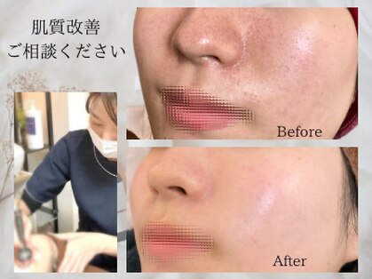 オーガニックラボ(オーガニックLab)の写真