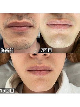 ガランテリー 御殿場店/抜け感に圧倒的自信あり