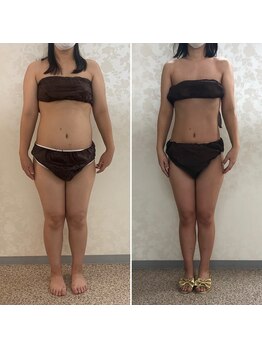 ビューティービューティー(beauty×beauty)/1ヶ月集中サイズダウンコース