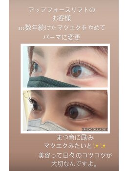 アミークス(Amicus)/