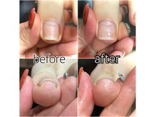 レイビューティー 一宮店(RAY+ Beauty)の雰囲気(爪に優しい施術で美しく長持ち。深爪や巻爪などのお悩みも◎)