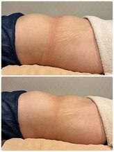 ビューティーサロン ラグジューム(Beauty salon Laxum)/赤岩式腸けずり