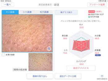 Rr.FACIAL郡山店　毛穴×たるみ×小顔専門店/