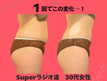 美方/横から見ても驚きの薄さへ