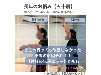 結(Yui)の写真