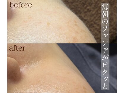 コモレビ(komorebi)の写真