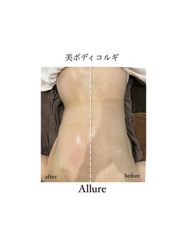 アリュール(Allure)/美ボディコルギ（４０代女性）