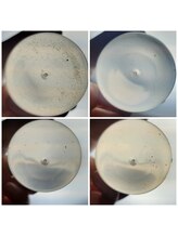 ボーテボナー(Beaute Bonheur)/♪毛穴洗浄フェイシャル♪