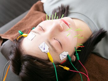 モグサ鍼灸院(MOXA鍼灸院)/本格美容鍼+電気パルスで小顔に