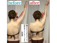 アモ(amo.)/筋膜リリース×ウィンバック