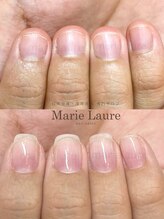 マリーロール 淀屋橋本店(Marie Laure)/自爪育成/深爪矯正/ネイルケア