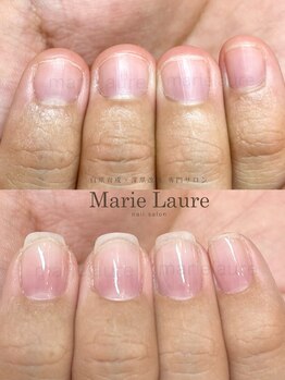 マリーロール 淀屋橋本店(Marie Laure)/自爪育成/深爪矯正/ネイルケア