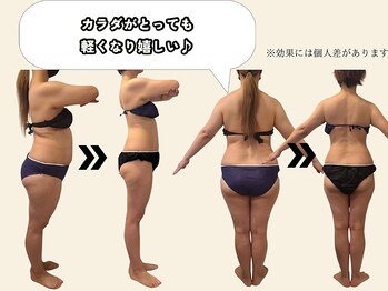 エルソル(elsol)/