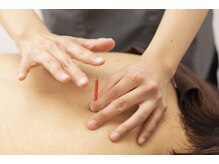 マッサージ鍼灸院つゆき按腹堂/奥まで届かせてコリを取ります！