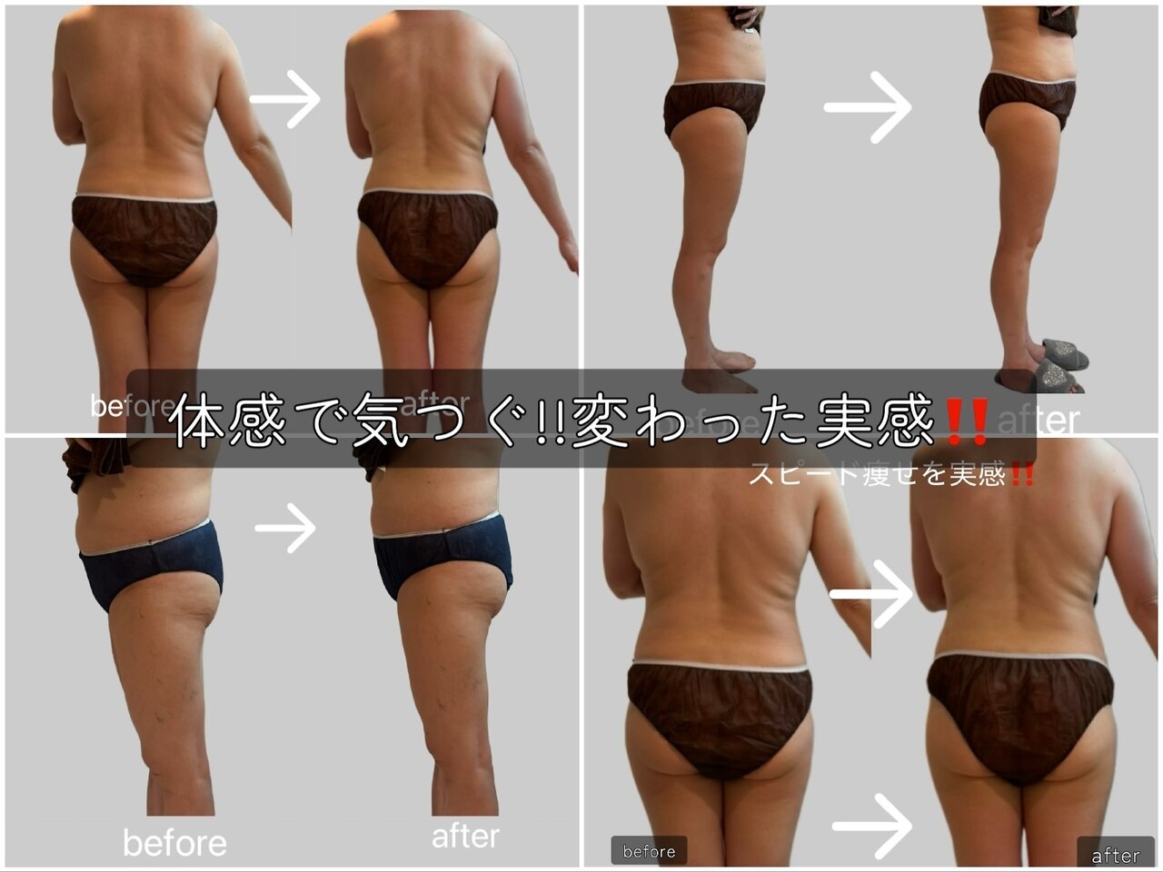 ヨサパーク ラウレアボディ 昭島店(YOSA PARK Laule'a Body