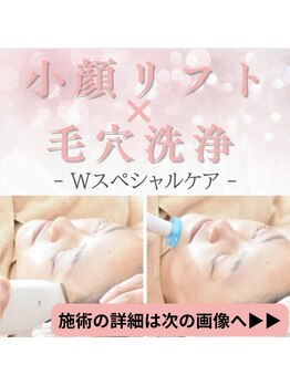 ルーセント/