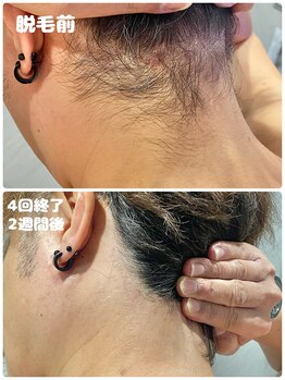 ワイズサロン(Y's salon)/4回終了2週間後