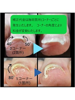 補正料金の計算方法