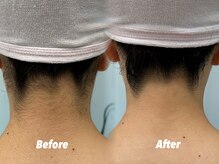 クイーン 渋谷店(QUEEN)/後ろ姿まで抜かりない肌へ