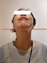 オージャス(OJAS)/40代のお客様/その場で小顔　