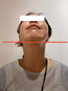 オージャス(OJAS)/40代のお客様/その場で小顔　