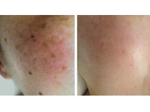 サロンドエステケイワイ(de KY)