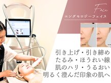 ミネルバ(MINERVA)