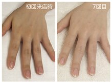 キレイテ 上野店/30代/7回目【ハンドケア上野】