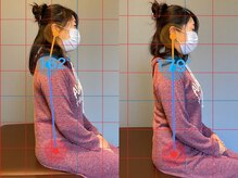 クリアリティ ボディ ケア(clearity body care)/姿勢矯正のビフォー&アフター♪