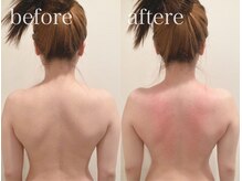 シンシアリー 広瀬通店(Sincerely)/before→after【背中/ウエスト】