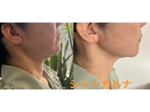 シャン カルナの雰囲気（大人気！！顔と首ケア、一回で実感、即効性）