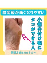 ニコ(niko)/小指の付け根にタコがある人