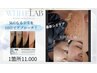 ホワイトラボ!最新シミケア♪カウンセリング0円(^^)