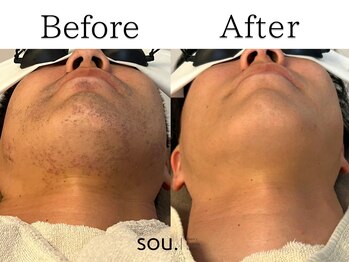 ソウ 野々市店(sou.)/