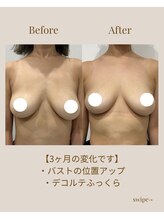 リネア(Linea)/【Before→After】30代前半